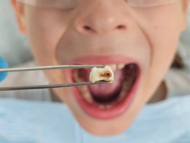 Best Tooth Infection Emergency Dentist  in Jefferson, IA